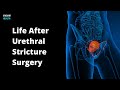 Life After Urethral Stricture Surgery