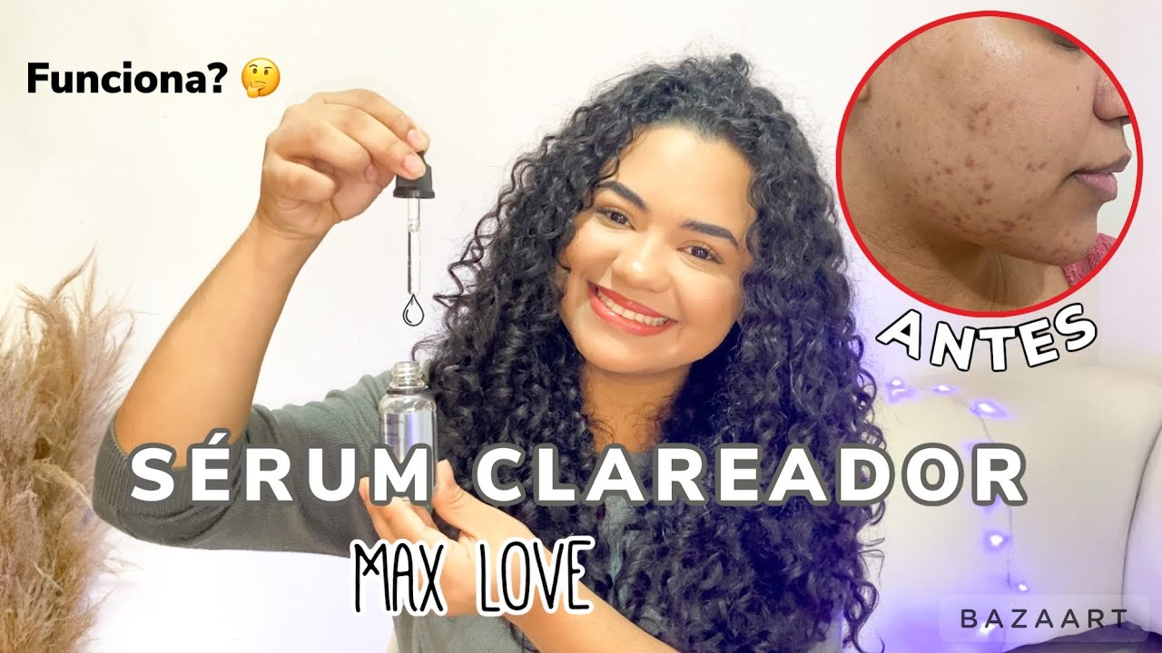 Watch Now Como clarear manchas de acne do rosto * SÉRUM CLAREADOR DA MAX LOVE* Como clarear manchas de acne do rosto * SÉRUM CLAREADOR DA MAX LOVE*
