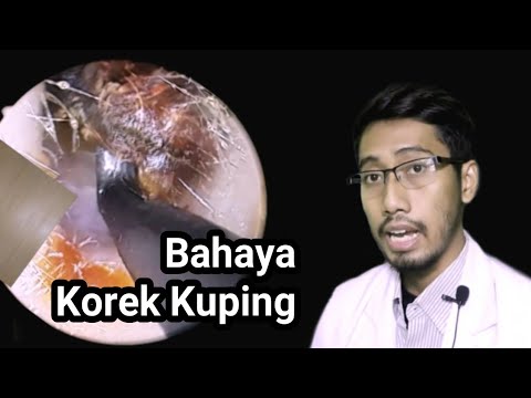 Telinga tersumbat ? Membersihkan Telinga dengan Cotton Bud Berbahaya? Ini Akibatnya & Pencegahannya