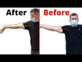 How To Get Full Elbow Extension Back After Injury