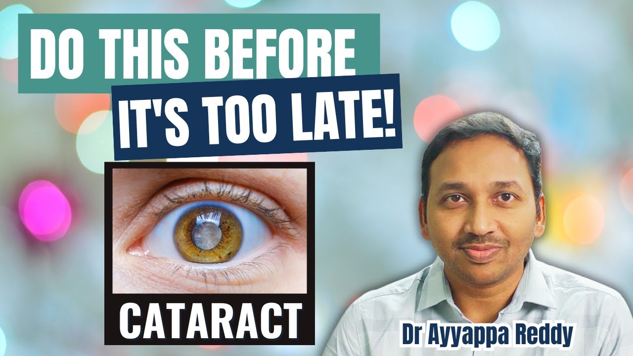 5 easy ways to prevent/delay cataracts (and reverse early damage!)