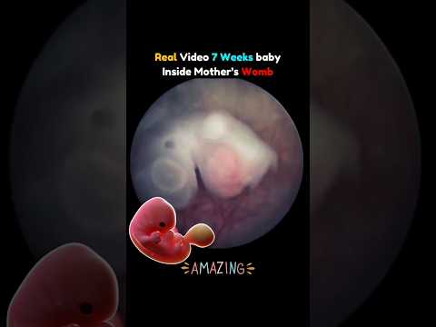 Real Video of 7 Weeks Baby in Mother's Womb 🥰💯 #pregnancy #fetus  #embryo