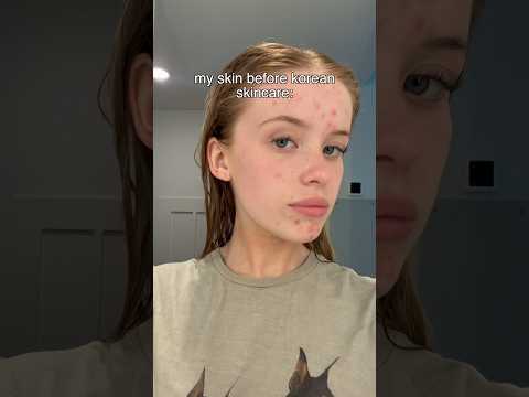 I tried a Korean skincare routine for 3 weeks heres the results so far✨see description 👇🏼😘🫶🏼