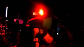 Download lagu Aborted - Coronary Reconstruction mp3 Download lagu Aborted - Coronary Reconstruction mp3