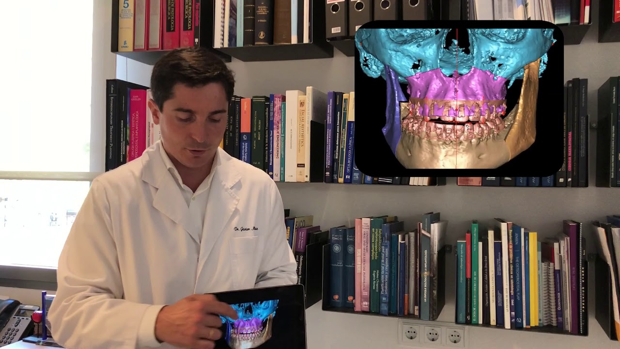 Javier Mareque Bueno-15