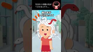 生まれつき髪の毛がヘビになってて