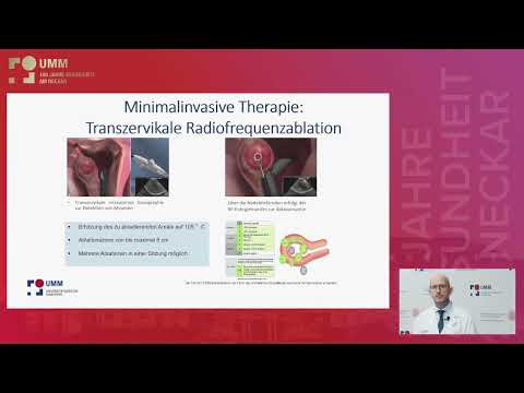 Myome der Gebärmutter: Diagnose und individuelle Therapie