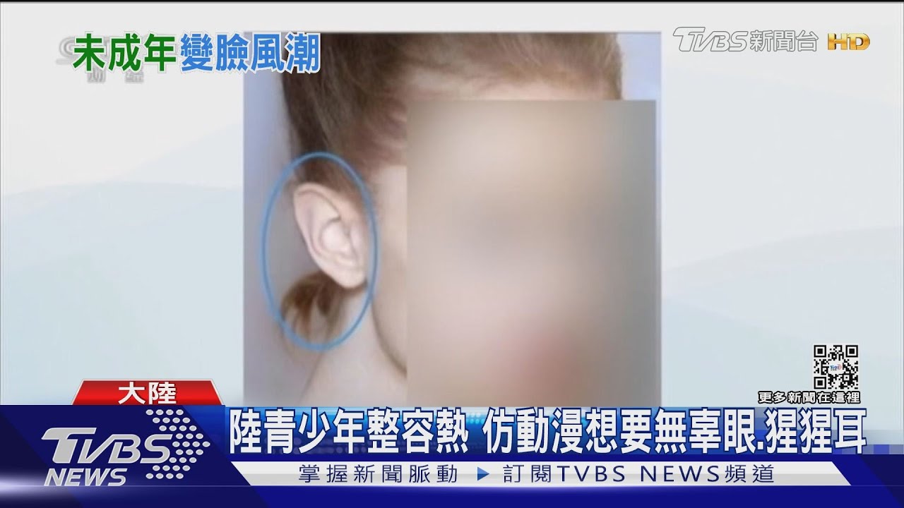 陸青少年整容熱 仿動漫想要無辜眼、猩猩耳