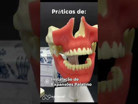 MANEQUIM COM RUGA PALATINA E LINHA MUCOGENGIVAL - cód. 4101GT