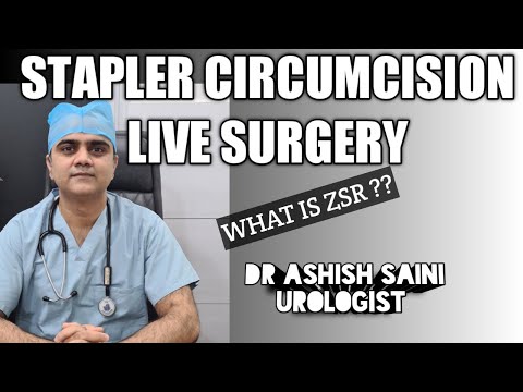 Circumcare Circumcision Stapler, For Surgery