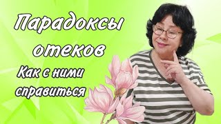 Парадоксы отеков и как от них избавиться