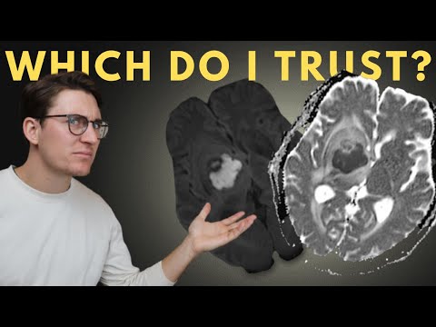 DWI vs ADC MRI sequences: EXPLAINED