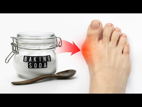 Shingles Natural Relief