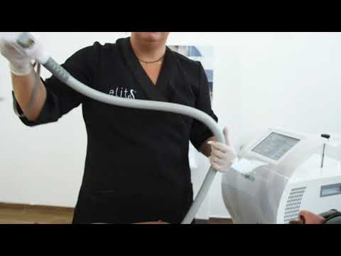 Behandlung mit dem EPIL808 SHR Laser | Dauerhafte Haarentfernung | Exklusiv bei WELLCOTEC erhältlich