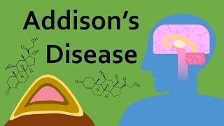 Addison's Disease and Corticosteroids (Part 1)