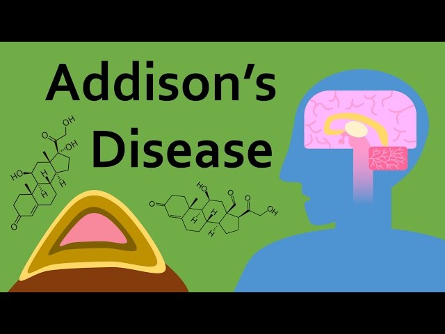 Video Pronunciation of adrenocorticotropic in English