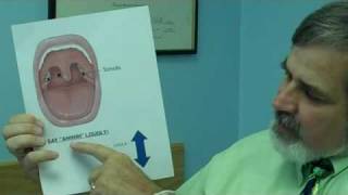 How to Perform a Rapid Strep Test