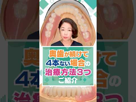 奥歯が続けて4本ない場合の治療方法3つご紹介！！