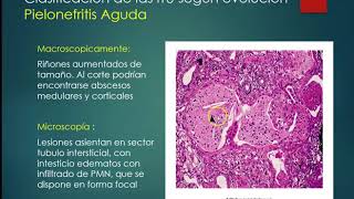 Infección urinaria