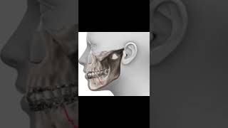 Download lagu Fracture of Mandible | ORIF | Sijo-Rocky fight | Bigg Boss | Scribble sparks #biggboss #sijo #bbms6 mp3 Download lagu Fracture of Mandible | ORIF | Sijo-Rocky fight | Bigg Boss | Scribble sparks #biggboss #sijo #bbms6 mp3