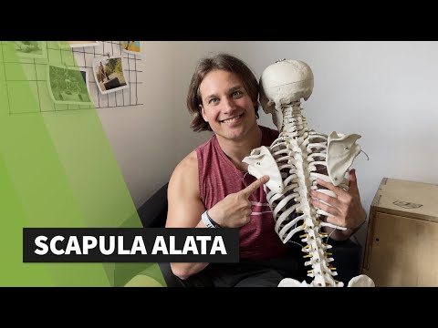 Schulterblattrand klappt extrem vom Brustkorb weg! (Scapula Alata)