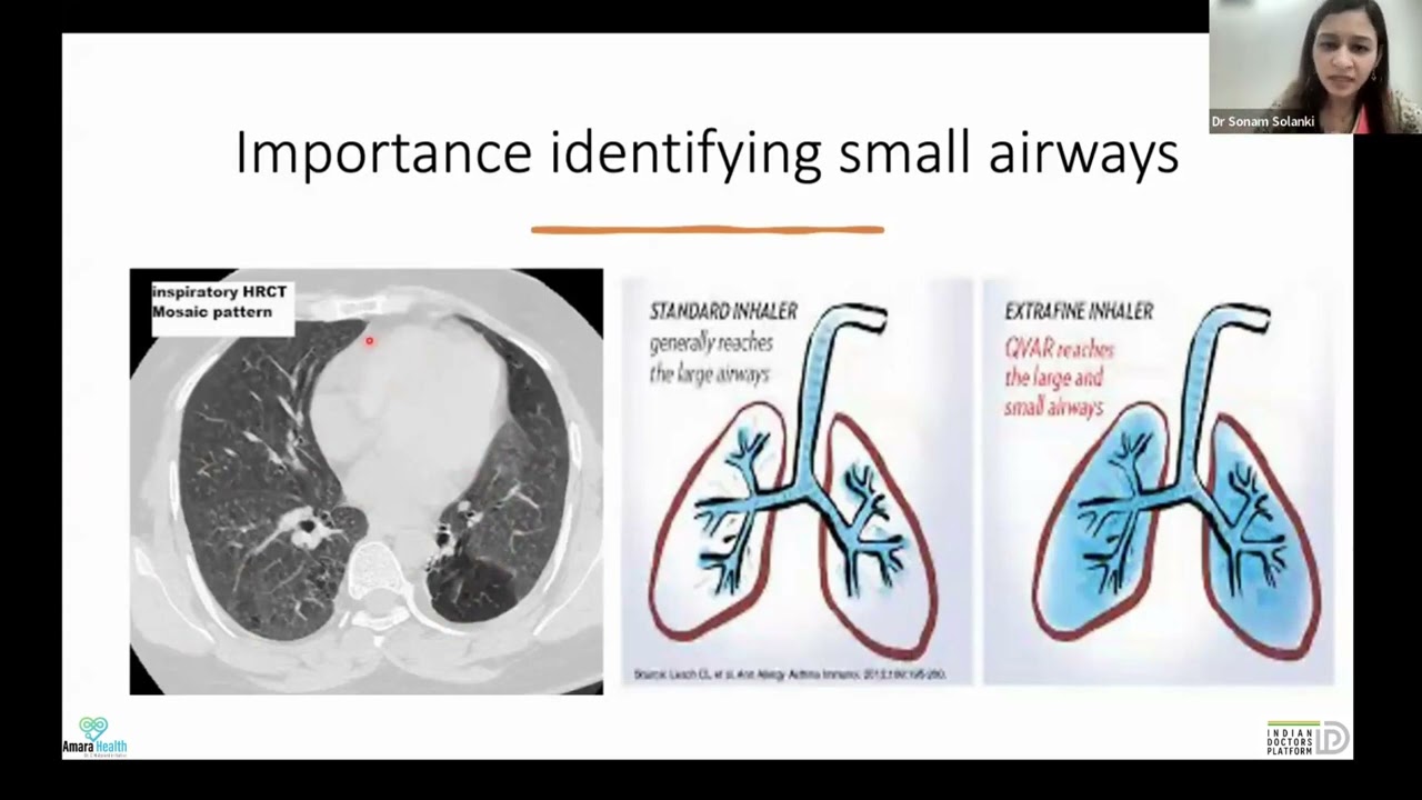 Managing airway diseases