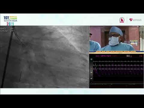 IVUS guided LM & Ostial and Proximal LAD PCI by Cross overtechnique – Dr.Rajesh Vijay Vergiya,
