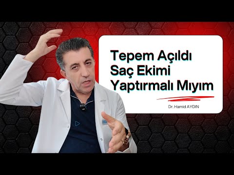 Tepem Açıldı Saç Ekimi Yaptırmalı Mıyım? Dr. Hamid AYDIN #saçekimi