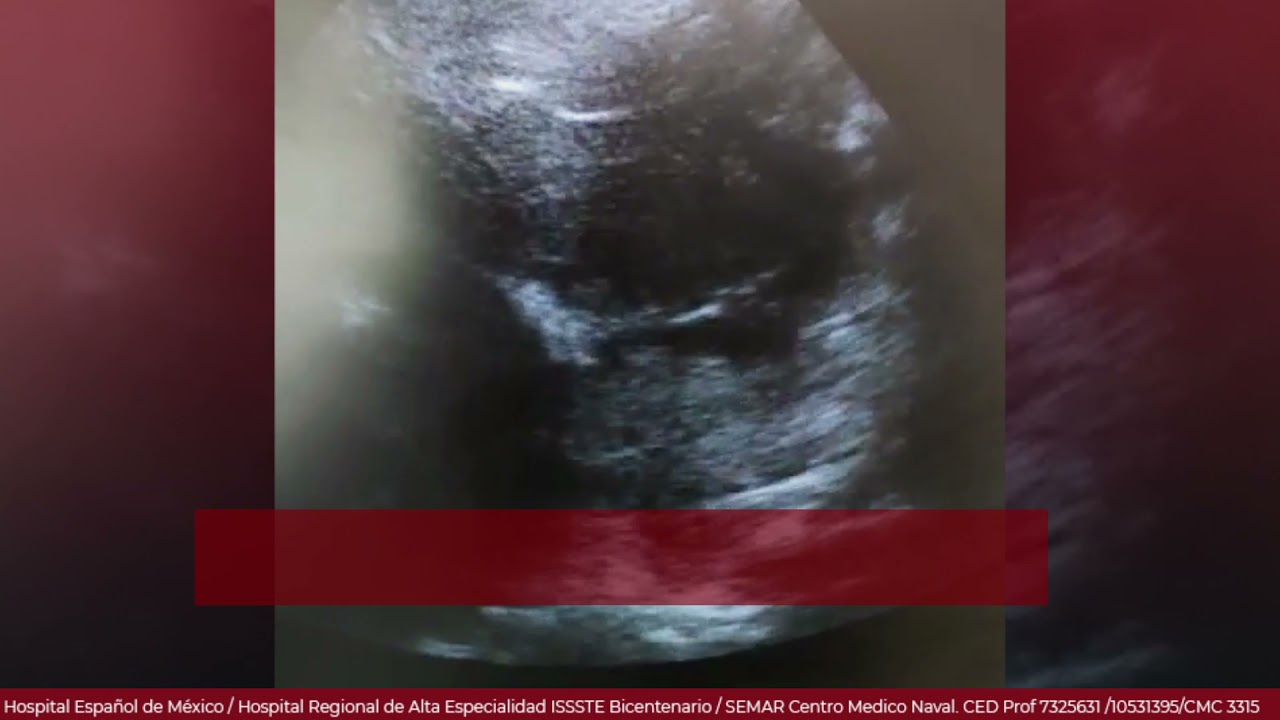 Marcelo Utrera Lagunas-94