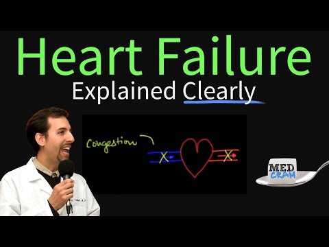 Heart Failure Explained Clearly - Congestive Heart Failure (CHF)