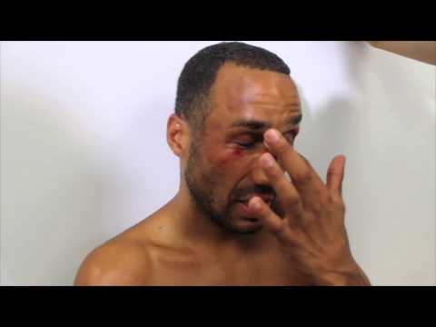 AN EMOTIONAL JAMES DeGALE WINS IBF WORLD TITLE & NOW LOOKS FOR UNIFICATION FIGHT WITH ANDRE WARD