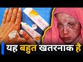 Melacare Cream Side Effects Melacare Cream Side Effects In Hindi