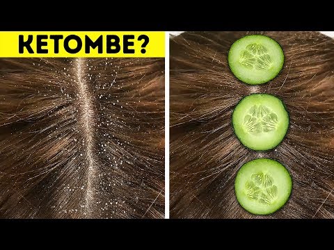 download lagu mp3 mp4 Tips Kecantikan Dari Timun, download lagu Tips Kecantikan Dari Timun gratis, unduh video klip Tips Kecantikan Dari Timun