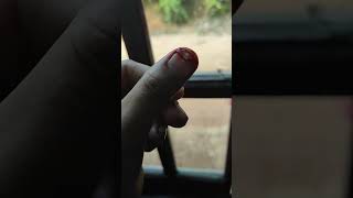 Download lagu tangan mamah terluka,berdarah kena pisau #youtubeshorts #terluka#berdarah#jambi mp3 Download lagu tangan mamah terluka,berdarah kena pisau #youtubeshorts #terluka#berdarah#jambi mp3