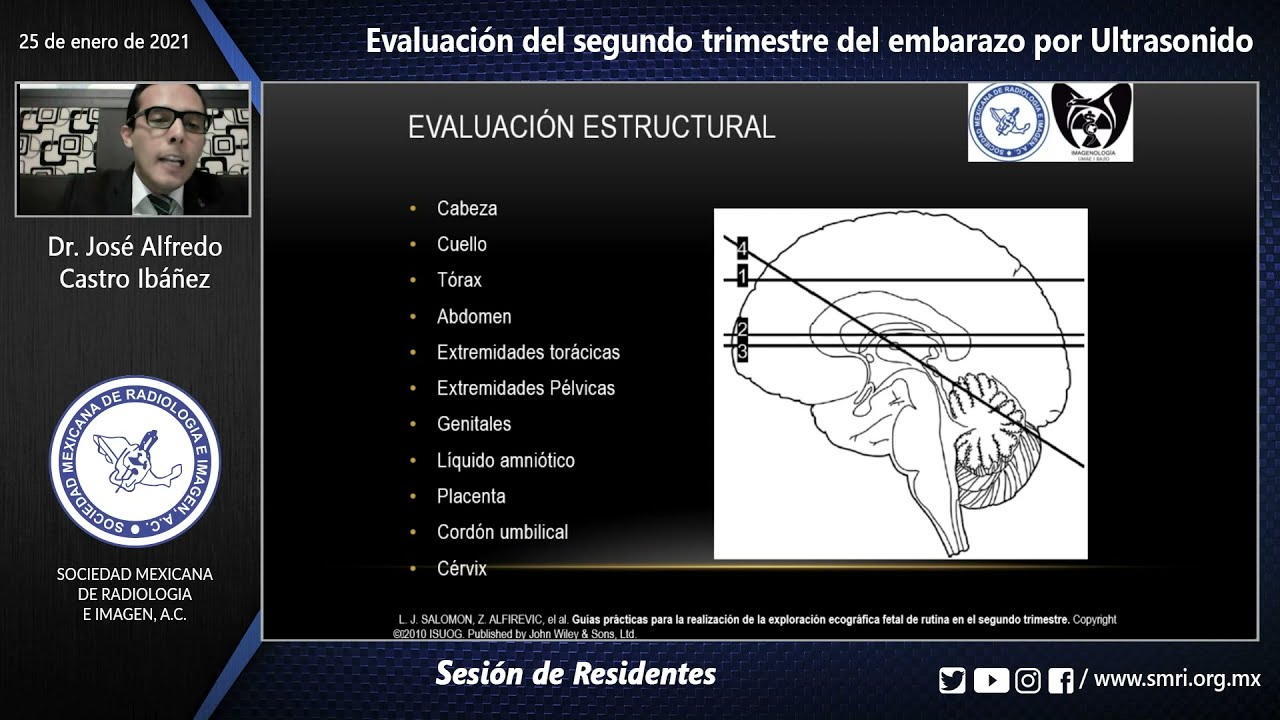 Sesión de Residentes: Evaluación del segundo trimestre del embarazo por Ultrasonido