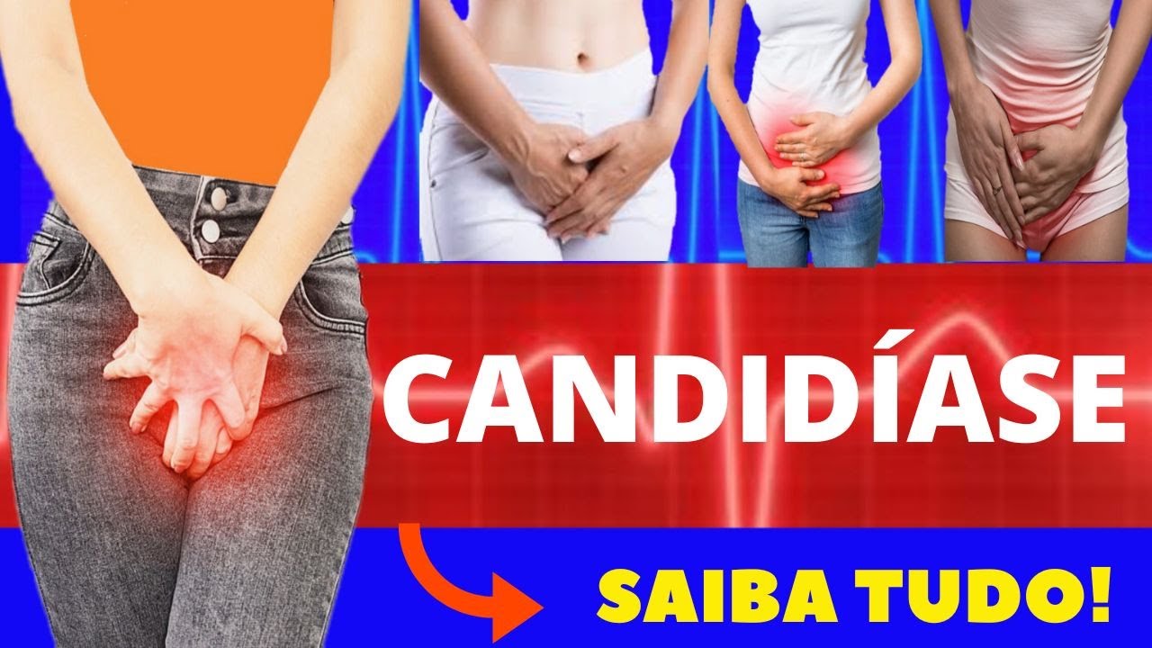 CANDIDÍASE - CAUSAS, SINTOMAS, DIAGNÓSTICO E TRATAMENTO - CANDIDÍASE DE REPETIÇÃO