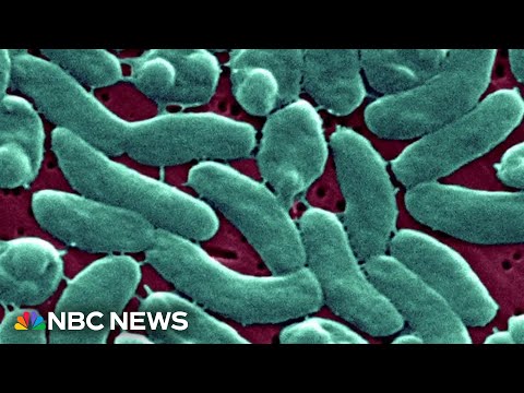 Four people dead from flesh-eating bacteria in Florida