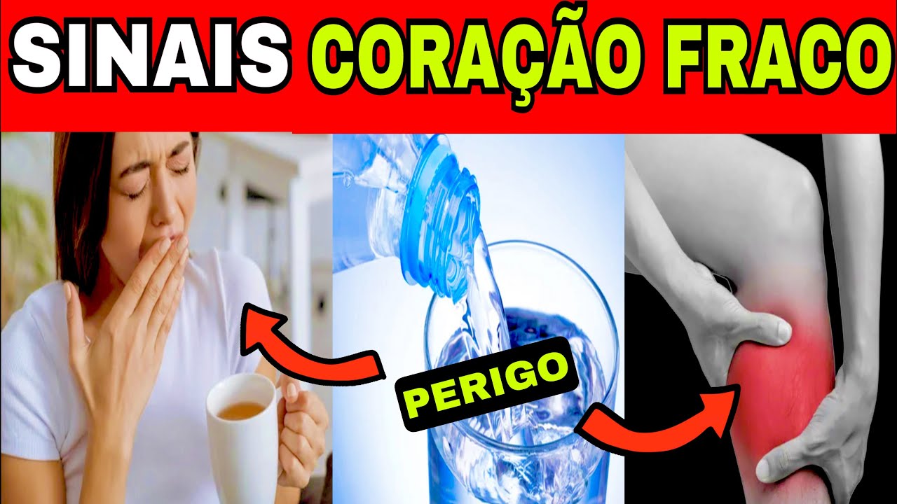 10 SINAIS de CORAÇÃO FRACO e 3 SINTOMAS de PERIGO na INSUFICIÊNCIA CARDÍACA