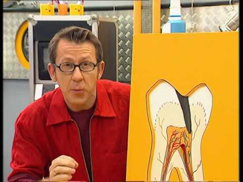 What are the different stages of a cavity? - It's not rocket science