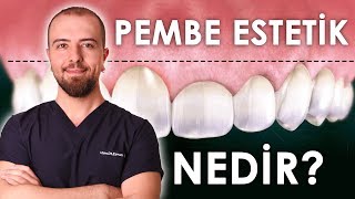Diş Eti Estetiği Pembe Estetik Nedir nasıl Yapılır  | Dr. Dt. Evren ÖZ