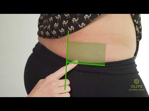 Progesterone Intramuscular Injection - Canada Olive Fertility Clinic