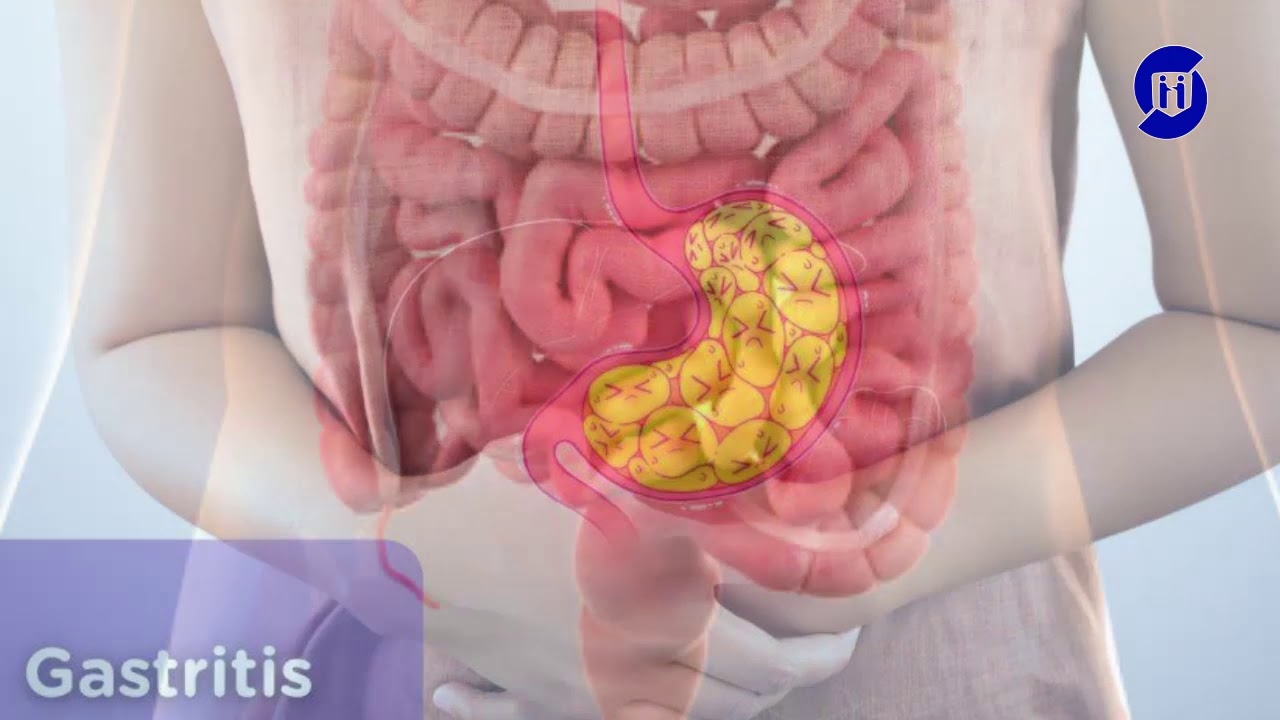 Pedro Lopez Sanabria-32