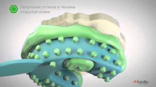 3. n. one слепочная ложка методика получения оттиска