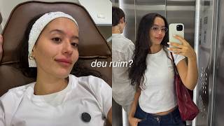 retirei meu preenchimento labial e fiz meu primeiro botox com 25 anos