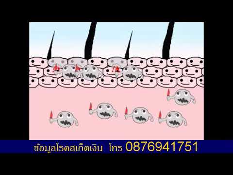 ซื้อจากร้องไห้กลาก ครีม Bepanten สำหรับโรคสะเก็ดเงิน