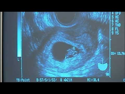 Pregnancies & Sleep Positions