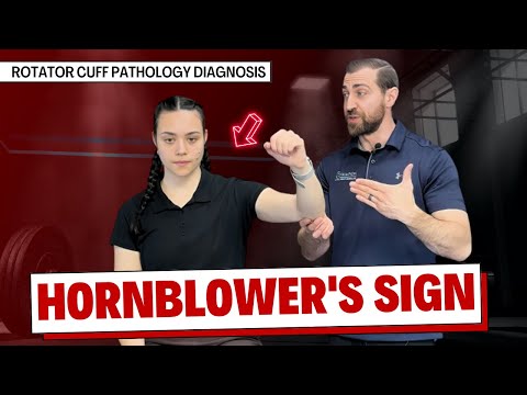 Hornblower's Sign for Rotator Cuff Pain Assessment