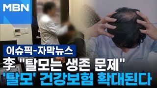 [자막뉴스] 이 대통령 ＂탈모는 생존 문제＂ 지적에…탈모 치료 건강보험 확대 추진 | 이슈픽