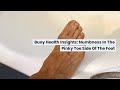 Numbness In The Pinky Toe Side Of The Foot Causes And When To Seek Medical Care BuoyHealth Com