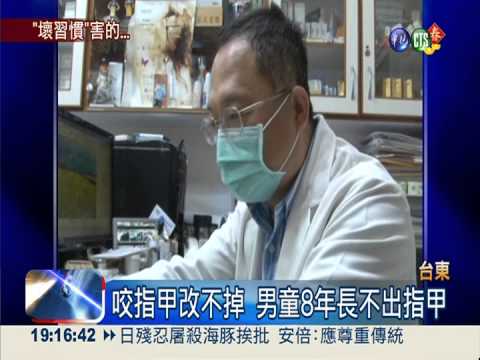 咬指甲改不掉 男童8年長不出指甲